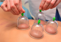 Terapia bańkami próżniowymi (poprawa odporności)-30 minut